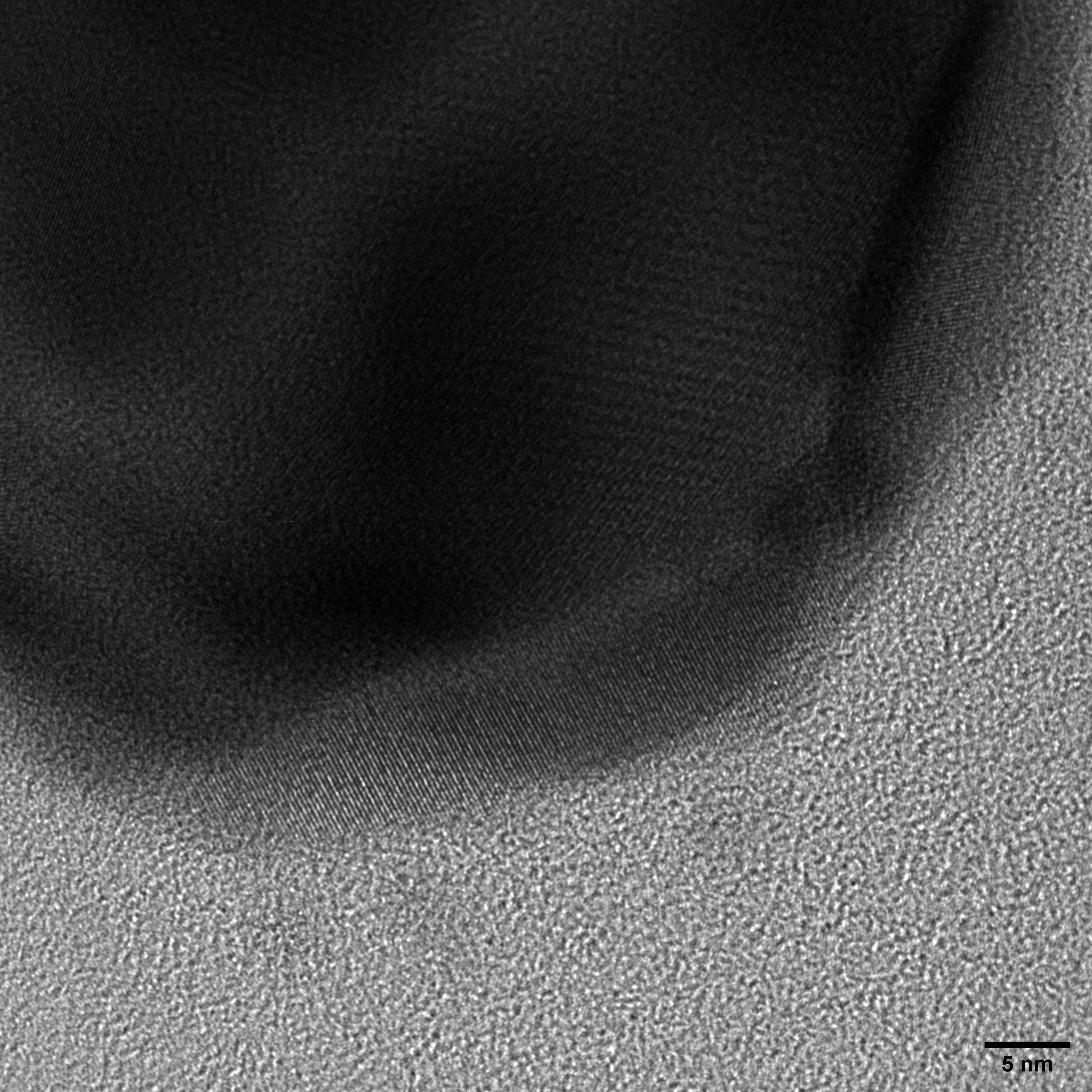 TEM image of the plasmonic hybrid nanostructure